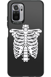 SKELETON - Xiaomi Redmi Note 10