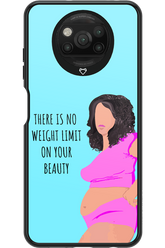 No Limit - Xiaomi Poco X3 Pro