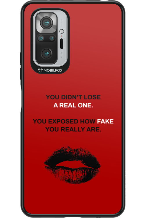 Real or Fake - Xiaomi Redmi Note 10S