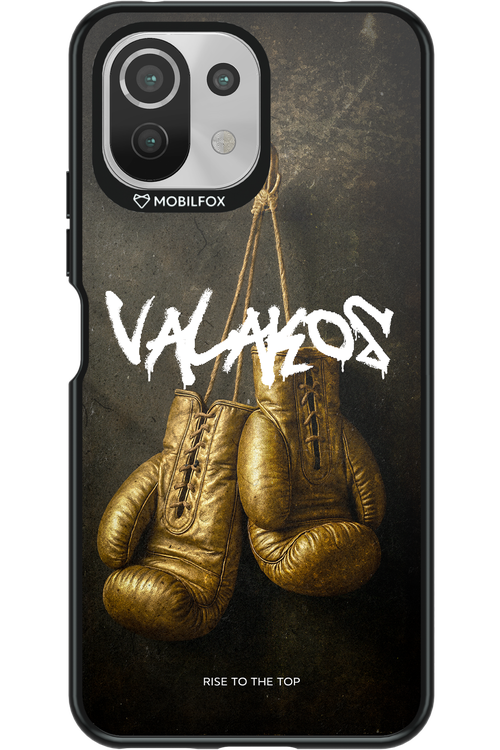 Golden - Xiaomi Mi 11 Lite (2021)