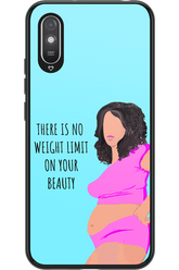 No Limit - Xiaomi Redmi 9A