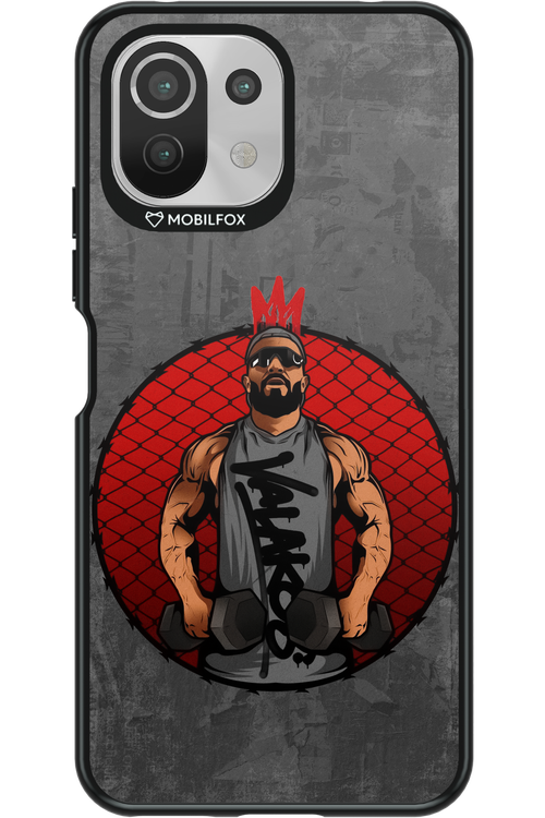 King V - Xiaomi Mi 11 Lite (2021)