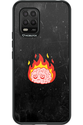 My brain - Xiaomi Mi 10 Lite 5G