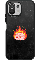 My brain - Xiaomi Mi 11 Lite (2021)