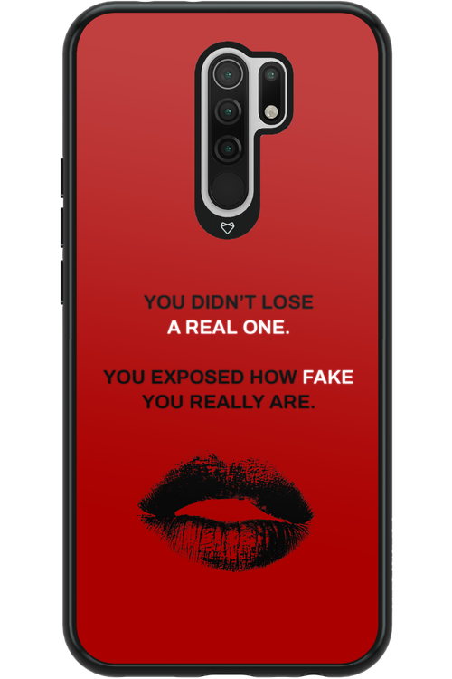 Real or Fake - Xiaomi Redmi 9