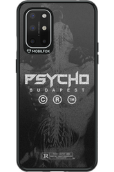 X-Ray - OnePlus 8T