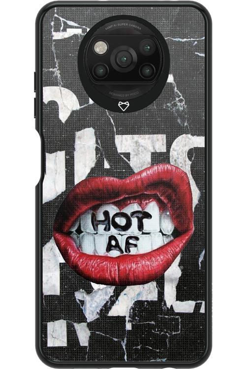 HOT AS F - Xiaomi Poco X3 NFC