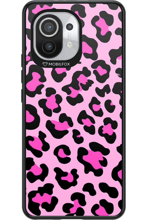 PINK LEOPARD 2.0 - Xiaomi Mi 11 5G