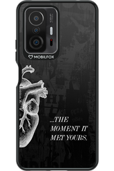His Heart 2.0 - Xiaomi Mi 11T