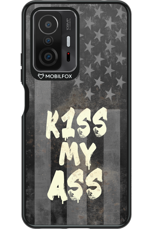 KISS II 2.0 - Xiaomi Mi 11T