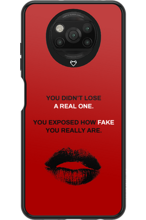 Real or Fake 2.0 - Xiaomi Poco X3 NFC