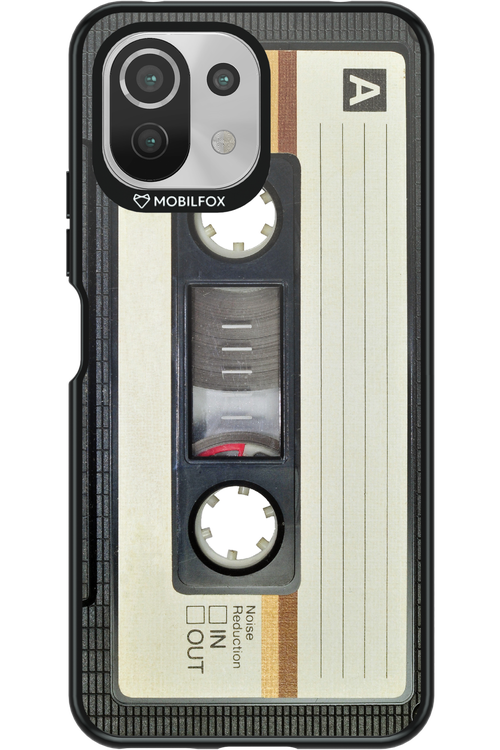 CASE 11 2.0 - Xiaomi Mi 11 Lite (2021)