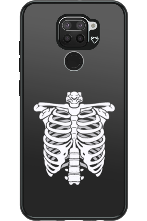 SKELETON - Xiaomi Redmi Note 9