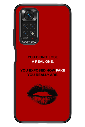 Real or Fake 2.0 - Xiaomi Redmi Note 11/11S 4G
