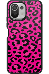 Fuchsia Leopard - Xiaomi Mi 11 Lite (2021)