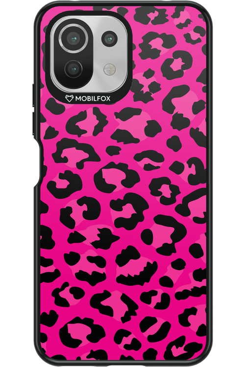 Fuchsia Leopard - Xiaomi Mi 11 Lite (2021)