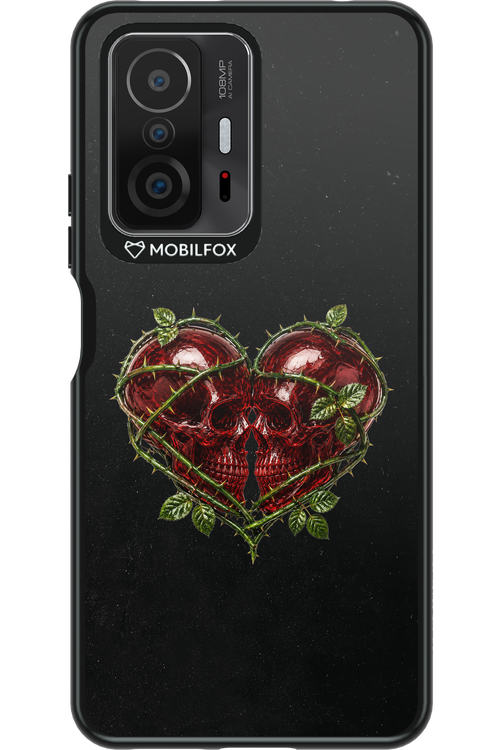 Omen Kiss 2.0 - Xiaomi Mi 11T