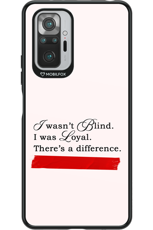 Difference - Xiaomi Redmi Note 10S