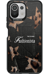 Iconic Fashionista - Xiaomi Mi 11 Lite (2021)