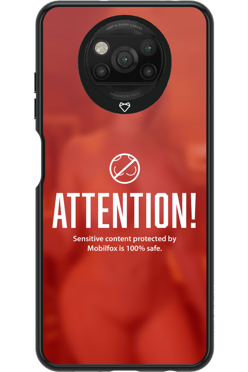 Attention 2.0 - Xiaomi Poco X3 Pro