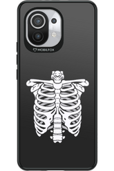 SKELETON - Xiaomi Mi 11 5G