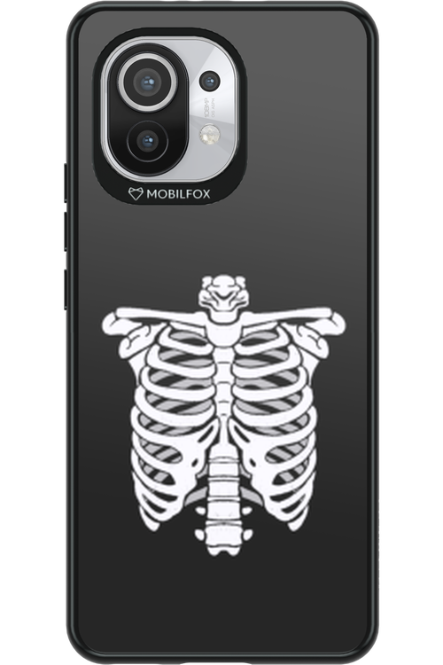 SKELETON - Xiaomi Mi 11 5G