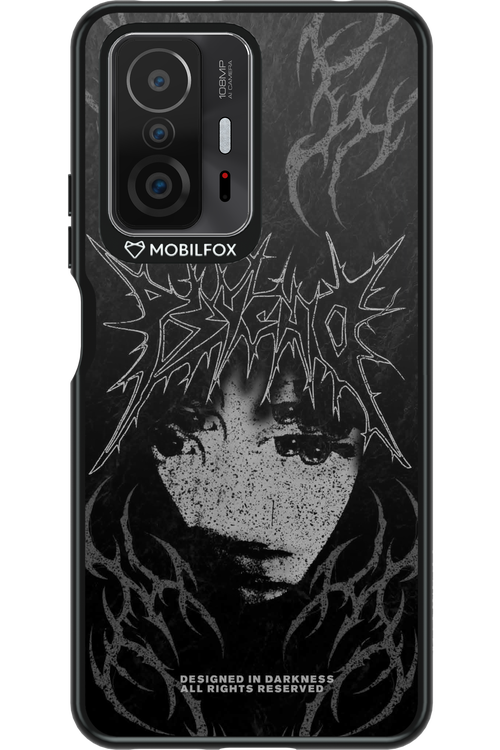 Schizo - Xiaomi Mi 11T