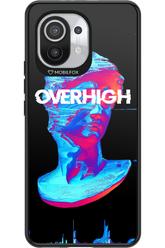 Overhigh - Xiaomi Mi 11 5G