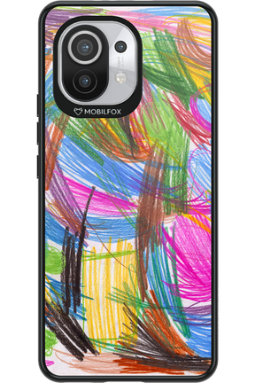 Xrax 2 2.0 - Xiaomi Mi 11 5G