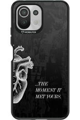His Heart 2.0 - Xiaomi Mi 11 Lite (2021)