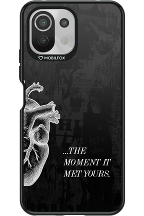 His Heart 2.0 - Xiaomi Mi 11 Lite (2021)