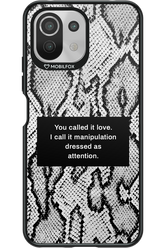 Manipulation - Xiaomi Mi 11 Lite (2021)