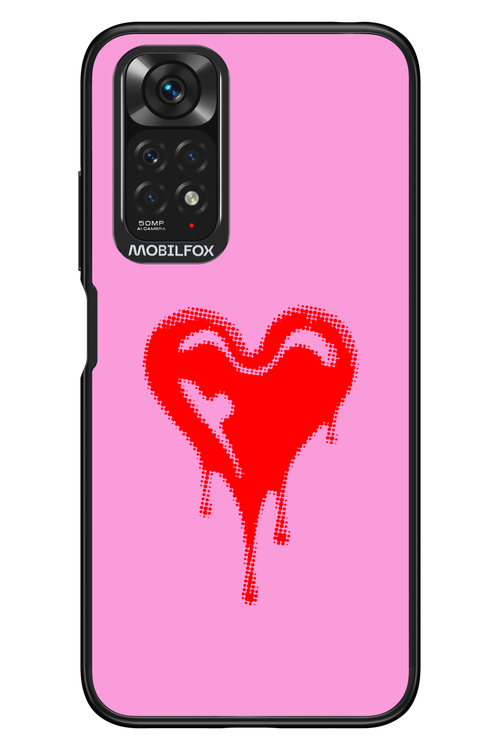 Heart Pink - Xiaomi Redmi Note 11/11S 4G