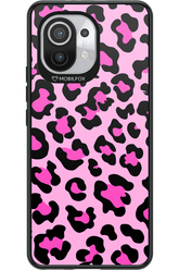 PINK LEOPARD - Xiaomi Mi 11 5G
