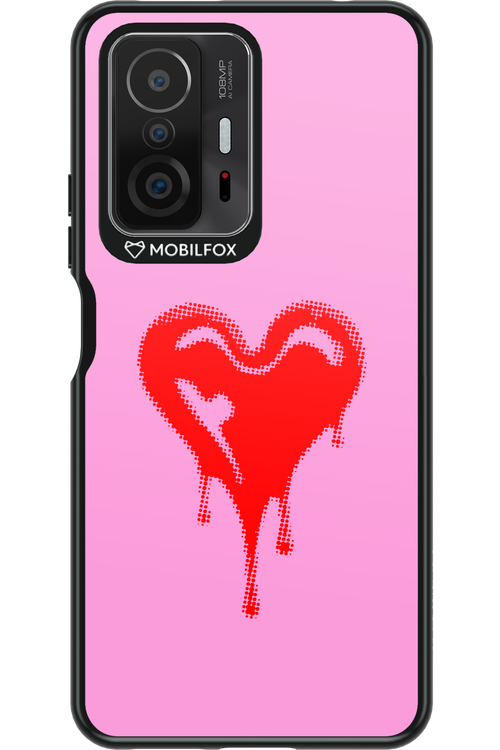 Heart Pink - Xiaomi Mi 11T