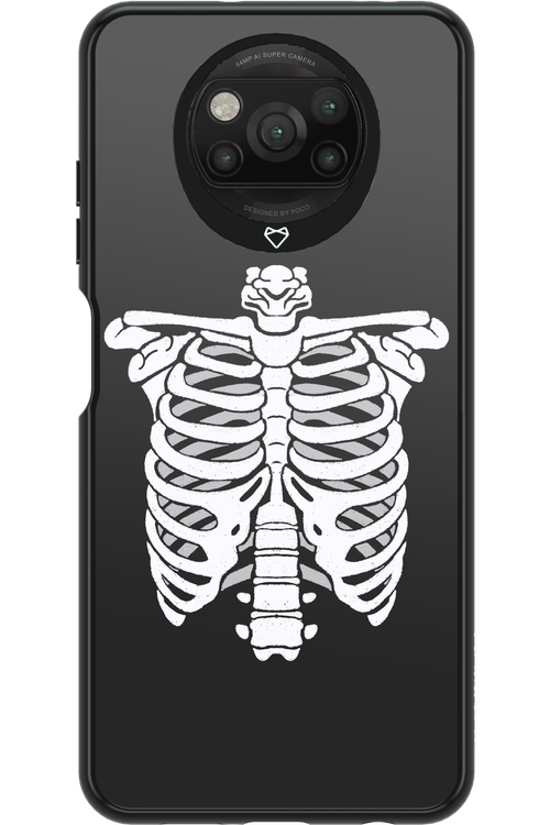 SKELETON - Xiaomi Poco X3 NFC