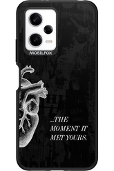 His Heart - Xiaomi Redmi Note 12 5G