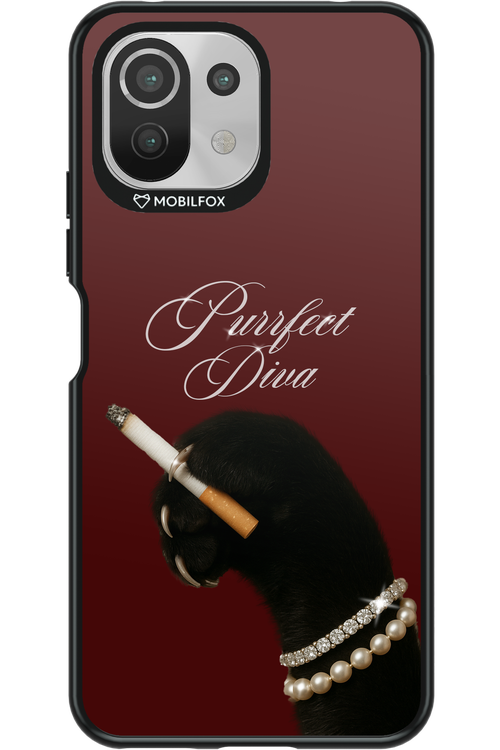 Purrfect Diva - Xiaomi Mi 11 Lite (2021)