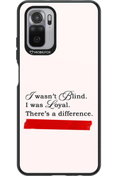 Difference 2.0 - Xiaomi Redmi Note 10