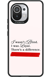 Difference 2.0 - Xiaomi Mi 11 5G