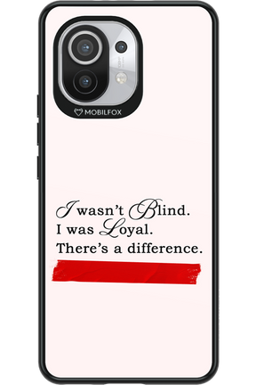 Difference 2.0 - Xiaomi Mi 11 5G