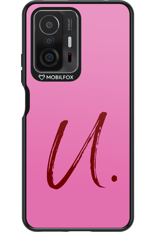 (Sorbet) U 2.0 - Xiaomi Mi 11T