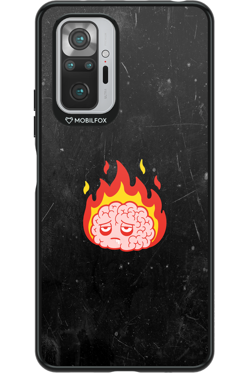 My brain - Xiaomi Redmi Note 10S