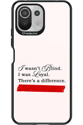 Difference 2.0 - Xiaomi Mi 11 Lite (2021)