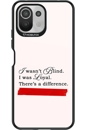Difference 2.0 - Xiaomi Mi 11 Lite (2021)