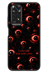 The Watchers - Xiaomi Redmi Note 11/11S 4G