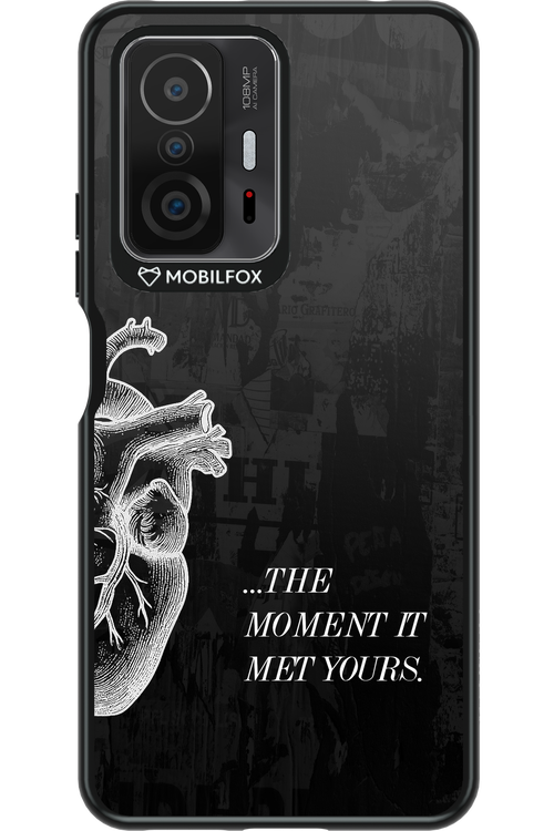 His Heart - Xiaomi Mi 11T