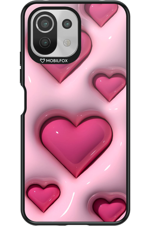 Nantia Hearts - Xiaomi Mi 11 Lite (2021)