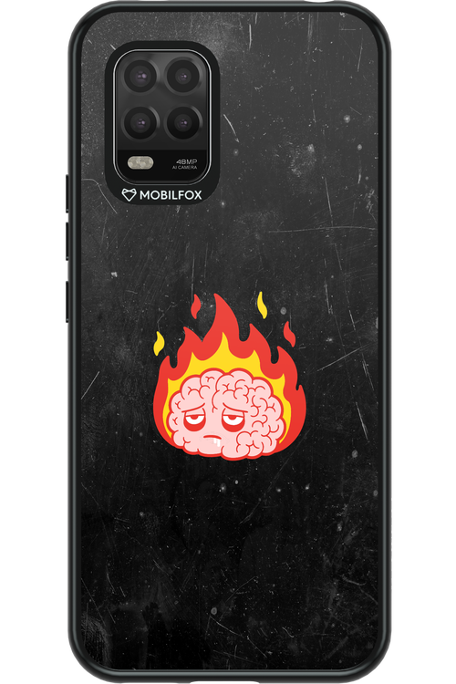 My brain - Xiaomi Mi 10 Lite 5G