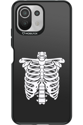 SKELETON - Xiaomi Mi 11 Lite (2021)